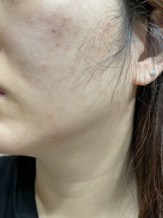 연어 피에이치 아크네 클렌징 리뷰 사진