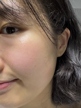 *✅프리 (블로그체험단) [밀리밀리] 메디 앰플 시카 15ml — 5점을 준 리뷰어가 2025년 9월 올린 사용 사진