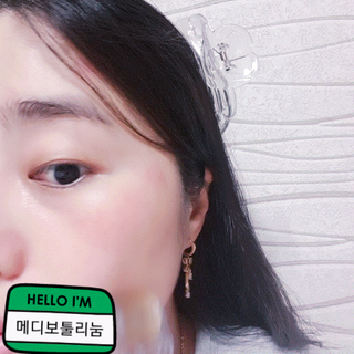 퍼퓸홀릭 [보툴리늄 원액] 7일의 변화 메디-보툴리늄 — 5점을 준 리뷰어가 2021년 9월 올린 사용 사진
