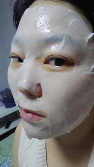 큐템 레이저 마스크 — 4.5점을 준 리뷰어가 2021년 1월 올린 사용 사진