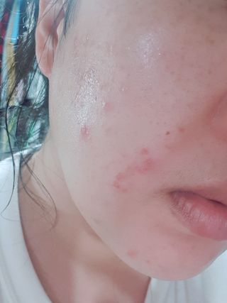 키노닉스 포텐틸라 카밍 크림 토너 — 5점을 준 리뷰어가 2021년 10월 올린 사용 사진