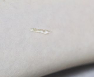 히루스카 포스트아크네 클리어 — 5점을 준 리뷰어가 2021년 2월 올린 사용 사진