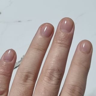 유케어 YOU CARE 문제성 손발톱케어_럭키풋 — 5점을 준 리뷰어가 2022년 10월 올린 사용 사진