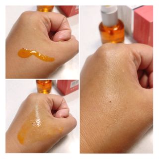 유니베르소 로즈힙 오일 15ml — 5점을 준 리뷰어가 2021년 7월 올린 사용 사진