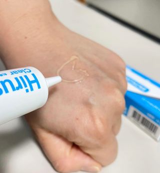 히루스카 포스트아크네 클리어 — 5점을 준 리뷰어가 2021년 2월 올린 사용 사진