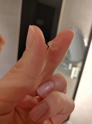 레드투래드 센서티브 어메이징 앰플 30ml — 4점을 준 리뷰어가 2021년 6월 올린 사용 사진