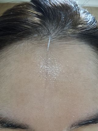 랑팡 EGF+FGF 10ppm 리포좀 앰플 원액 10ml — 5점을 준 리뷰어가 2021년 11월 올린 사용 사진