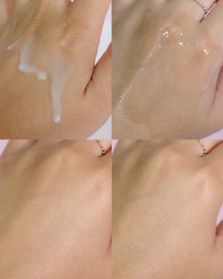 바이오오일 [바이오-오일] 바디 로션 175ml — 5점을 준 리뷰어가 2021년 9월 올린 사용 사진