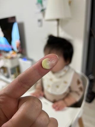 건선/아토/습진/민감성 피부 천연보습진정크림 소리온 크림 & 센시티브 크림 50g — 5점을 준 리뷰어가 2022년 1월 올린 사용 사진