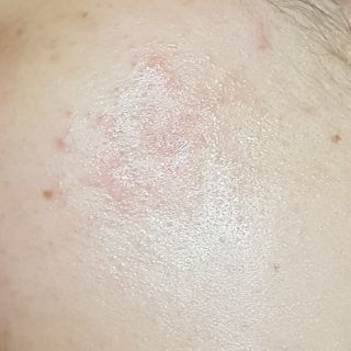 리더스코스메틱 리더스 카밍 바이오틱스 에센스 워터 — 5점을 준 리뷰어가 2021년 3월 올린 사용 사진