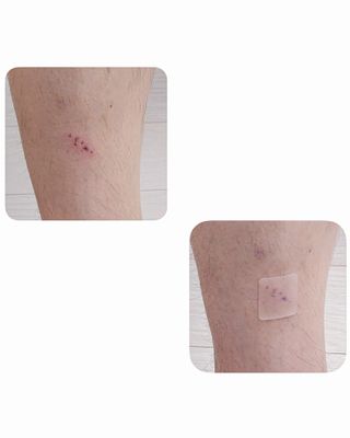 [큐어반H 커팅] 간편하게 떼서 쓰는 자외선차단 습윤밴드 (1팩/30매입) — 5점을 준 리뷰어가 2022년 11월 올린 사용 사진