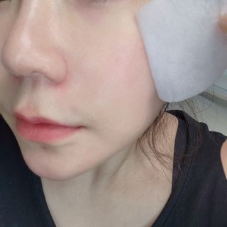 리더스코스메틱 리더스 카밍 바이오틱스 퀵 수딩 패드 — 5점을 준 리뷰어가 2022년 5월 올린 사용 사진