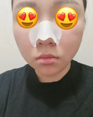세뚜아(Cettua) 세뚜아 스티키 포어 패치 Cettua Sticky Pore Patch — 5점을 준 리뷰어가 2023년 8월 올린 사용 사진