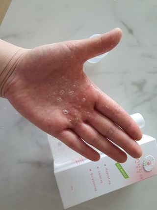 [시카앰플] 묘오한 고마진정할때 진정 스프레이 앰플 150ml — 4점을 준 리뷰어가 2021년 3월 올린 사용 사진