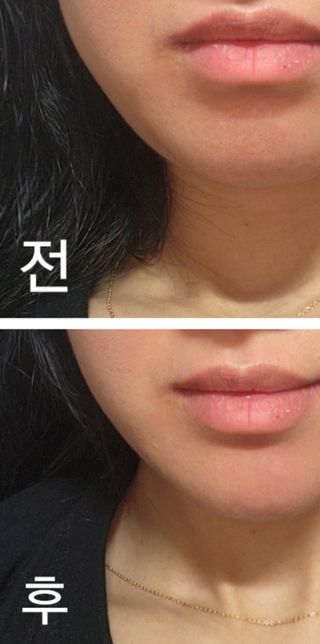 하니님이 올린 리뷰 사진 1