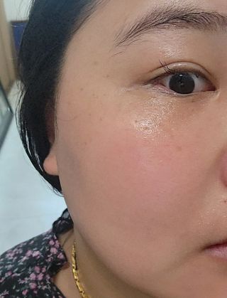 나우 [리브엠] 123억개 엑소좀으로 채운 눈부신 광채, 엑소코어 화이트닝 텐션 앰플 — 5점을 준 리뷰어가 2023년 8월 올린 사용 사진