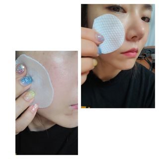 커스토젠 아크슈터 마이크로바이옴 토너패드 파우치타입 이중패드 1박스(50매) — 5점을 준 리뷰어가 2022년 7월 올린 사용 사진