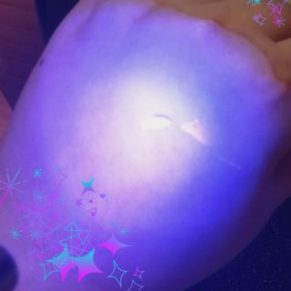 메데스 비츠케어 모공케어 피부관리키트 — 4점을 준 리뷰어가 2021년 6월 올린 사용 사진