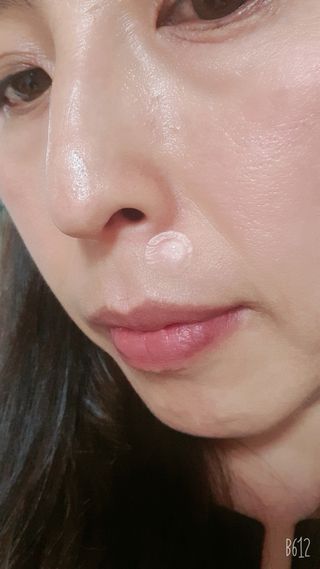 올리브영 엘라밴드 하이드로 도트 스팟패치 12mm, 티트리 — 4점을 준 리뷰어가 2022년 9월 올린 사용 사진