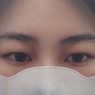 아이디플라코스메틱 아이디 페이스핏 플러스 패치 v2 — 5점을 준 리뷰어가 2020년 12월 올린 사용 사진