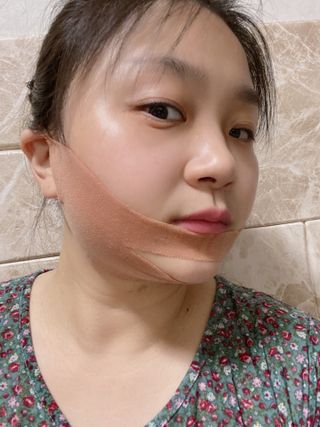 아이디플라코스메틱 아이디 페이스핏 마이너스 밴드 v2 — 3.5점을 준 리뷰어가 2022년 5월 올린 사용 사진