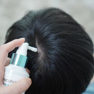 모두발라 탈모집중케어 헤어토닉 — 5점을 준 리뷰어가 2021년 12월 올린 사용 사진