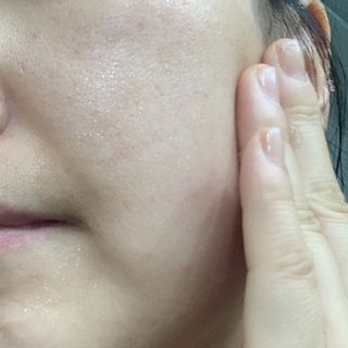 [스킨1004] 마다가스카르 센텔라 앰플 100ml — 4.5점을 준 리뷰어가 2024년 5월 올린 사용 사진
