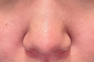 세뚜아(Cettua) 세뚜아 스티키 포어 패치 Cettua Sticky Pore Patch — 4점을 준 리뷰어가 2023년 8월 올린 사용 사진