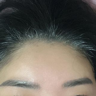 아이디플라코스메틱 페이스핏 플라스터 마스크 _ 리뉴얼 — 2.5점을 준 리뷰어가 2022년 4월 올린 사용 사진