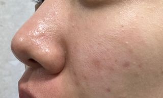 프리타임1 프리타임 파파야 엔자임 워시, 파우더 페이스 폼 클렌저 — 4.5점을 준 리뷰어가 2023년 3월 올린 사용 사진