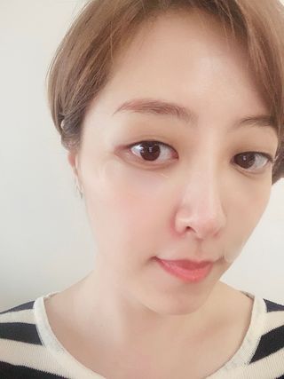 마이디플러스 트리플부스팅, 트러블 릴리프 케어 마이크로 패치 2종 중 택1 — 4점을 준 리뷰어가 2021년 11월 올린 사용 사진