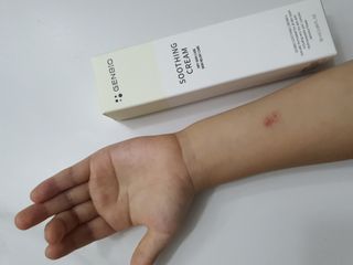 젠바이오 코스메틱스 젠바이오수딩크림]   가려운 피부 & 아토피 원픽 크림 — 5점을 준 리뷰어가 2022년 8월 올린 사용 사진