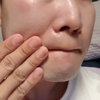 [AHC] 세이프온 에센스 선크림 올리브영 스페셜 증정 기획세트 — 5점을 준 리뷰어가 2022년 6월 올린 사용 사진