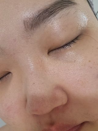 나나스킨 콤플렉스씨쓰리닥터클리어앰플 — 5점을 준 리뷰어가 2021년 3월 올린 사용 사진