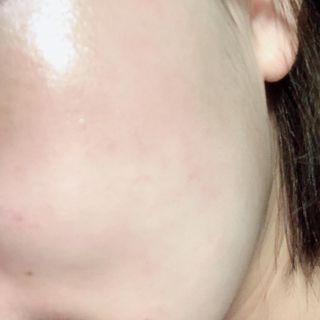 아이앤립 / EYENLIP 아이앤립 24K 골드 N 펩타이드 앰플 크림 — 3.5점을 준 리뷰어가 2021년 6월 올린 사용 사진