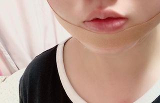 아이디플라코스메틱 아이디 페이스핏 마이너스 밴드 v2 — 2.5점을 준 리뷰어가 2020년 12월 올린 사용 사진