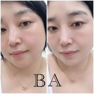 더메디코템 일루미네이팅 오로라 에멀젼마스크 — 5점을 준 리뷰어가 2025년 6월 올린 사용 사진