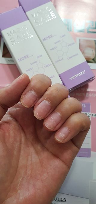 뷰젤 매직케어 네일솔루션 손발톱 보습 영양제 펜슬타입 5ml — 5점을 준 리뷰어가 2022년 3월 올린 사용 사진