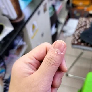 젤리핏 피치리페어 10ml 피치 컬러영양제 효과있는 손톱강화제 — 5점을 준 리뷰어가 2022년 7월 올린 사용 사진