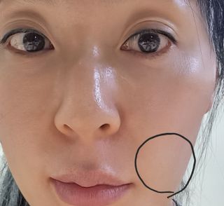 [큐어반H 스팟] 자외선 99프로 차단되는 스틱타입 스팟밴드(1팩 / 66매입) — 5점을 준 리뷰어가 2022년 11월 올린 사용 사진
