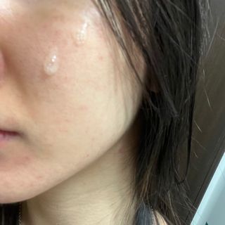 체르엠 스템앤셀 비타민 브라이트닝 에센스 30ml 1개 — 4.5점을 준 리뷰어가 2022년 2월 올린 사용 사진