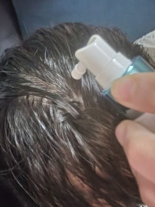 모두발라 탈모집중케어 헤어토닉 — 5점을 준 리뷰어가 2021년 12월 올린 사용 사진