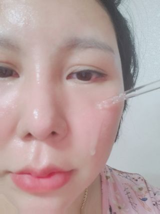 나나스킨 콤플렉스씨쓰리닥터클리어앰플 — 5점을 준 리뷰어가 2021년 5월 올린 사용 사진