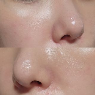 세뚜아(Cettua) 세뚜아 스티키 포어 패치 Cettua Sticky Pore Patch — 5점을 준 리뷰어가 2023년 9월 올린 사용 사진
