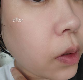 약손명가코스메틱 필킨 블룸 셀 브라이트닝 마스크 — 5점을 준 리뷰어가 2022년 6월 올린 사용 사진