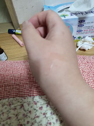 랑팡 EGF+FGF 10ppm 리포좀 앰플 원액 10ml — 3.5점을 준 리뷰어가 2021년 11월 올린 사용 사진