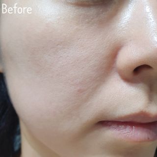 리더스코스메틱 리더스 카밍 바이오틱스 #1등 진정 기획세트 [에센스 워터150ml + 크림 마스크80ml] — 5점을 준 리뷰어가 2022년 8월 올린 사용 사진