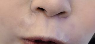 소담스퀘어 상암 디팩코퍼레이션 놀라아워 비건 하이드로콜로이드 클리어 패치 — 5점을 준 리뷰어가 2022년 12월 올린 사용 사진