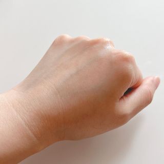 작심연구소 바르는 피부과 레이저 메디스팟크림 플러스 — 5점을 준 리뷰어가 2022년 6월 올린 사용 사진