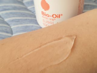 바이오오일 [바이오-오일] 드라이 스킨 젤 100ml — 4.5점을 준 리뷰어가 2021년 7월 올린 사용 사진